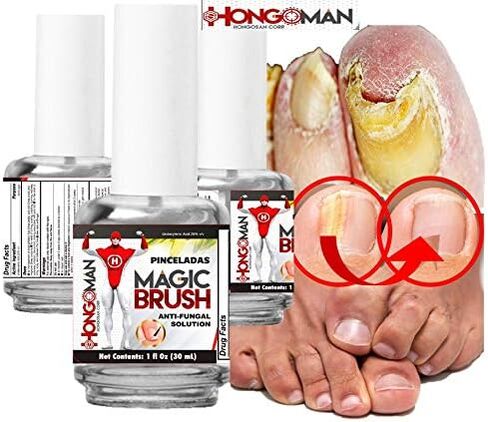 2 Hongosan أفضل منتج مضاد للفطريات لأظافر القدم، أفضل منتج سريع 4 Clear Nail Hongosan Para Combatir Los Hongos En Las Uñas in Saudi Arabia