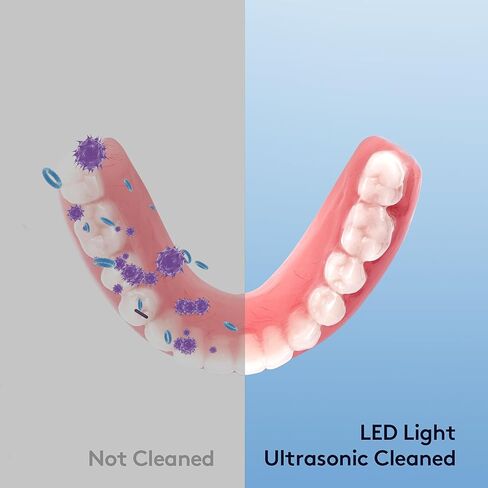منظف ​​بالموجات فوق الصوتية لأطقم الأسنان، المثبت، واقي الفم، المصفف، صواني التبييض، رأس فرشاة الأسنان، آلة تنظيف المثبات بالموجات فوق الصوتية 45 كيلو هرتز لجميع أجهزة طب الأسنان، المجوهرات، الماس in Kuwait