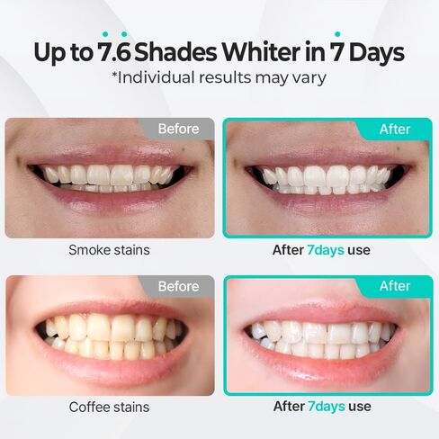 Whitening Toothpaste 80g - Fluoride-Free Stain Removal, Strengthens Enamel, Natural Ingredients, Fresh Mint Flavor in Saudi Arabia