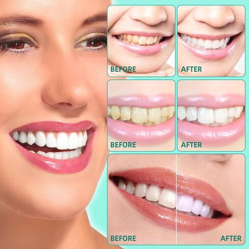 سحب غسول الفم بالزيت للسفر 20 عبوة، عبوات غسول الفم للسفر للتنفس المنعش، سحب زيت النعناع الخفيف، سحب زيت جوز الهند الطبيعي لتبييض الأسنان ولثة أكثر صحة، خالي من الكحول in Kuwait