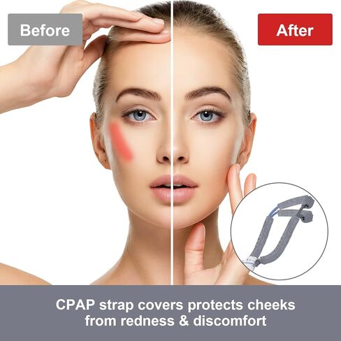 Satin CPAP Strap Covers, CPAP Mask Cover to Fit Airfit P10 Headgear Strap, Universal and Comfort CPAP Headgear Strap Covers, CPAP Hair Protector for Women for Reducing Red Marks (Pink) in Kuwait