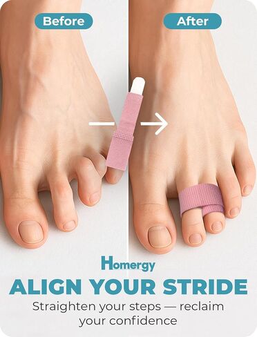 Homergy Hammer Toe Corrector & Straightener, 4-Pack Toe Tape for Women in Saudi Arabia