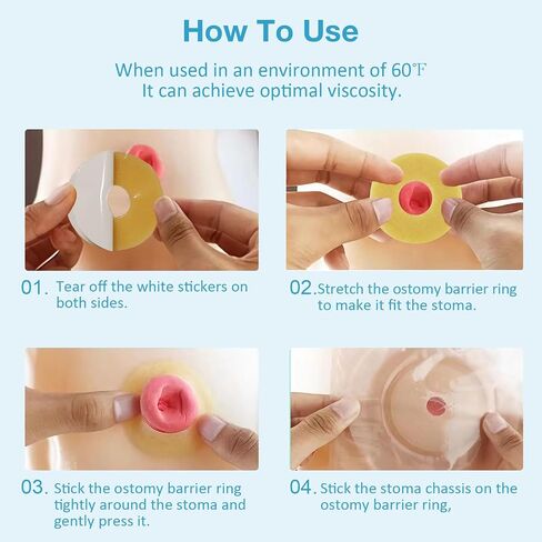 40 PCS Ostomy Barrier Strips, Medical Grade Hydrocolloid, Ostomy Supplies, Elastic Barrier Adhesive Tape for Colostomy Bags, Urostomy Bag, Ileostomy Bag in Saudi Arabia