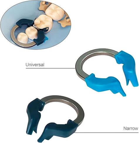 Dental Matrix Ring Set, Dental Sectional Contoured Matrix Bands Nickel Titanium Clamping Clip Ring Dental Separation Ring Dentist Tools (C2) in Saudi Arabia