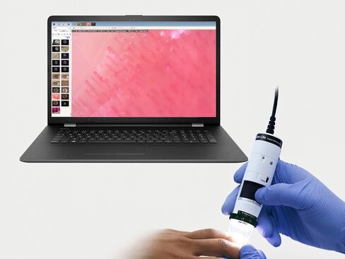 Dino-Lite Medical Capillaroscope | Dino-Med Edge Series | USB and Wireless | WF4515-N2UT(W) in Saudi Arabia