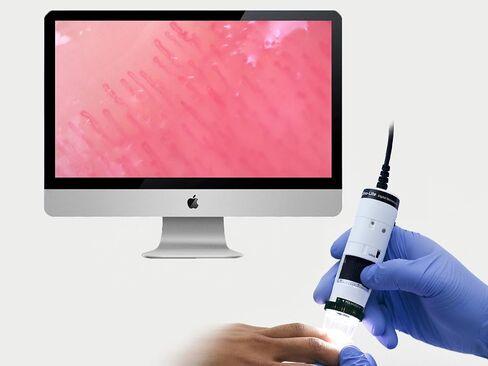 Dino-Lite Medical Capillaroscope | Dino-Med Edge Series | USB and Wireless | WF4515-N2UT(W) in Saudi Arabia