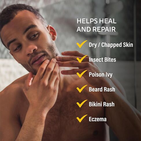 A+D Medicated Rash Ointment 15.2 oz– Relieves Irritated Skin from Poison Ivy, Eczema, Beard & Bikini Rash, Dry & Chapped Skin, Bug Bites. Made with Colloidal Oatmeal in Kuwait