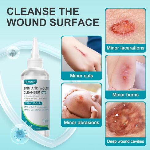 Dimora Skin and Wound Cleanser, OTC First Aid Antiseptic Cleanser,Moistening Absorbent Antibacterial Wound Dressings for Cuts, Abrasions, Lacerations, Burns, Skin Cleansing and Rinsing -8oz / 237mL in Saudi Arabia