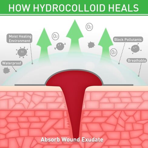 Hydrocolloid Bandages,Hydrocolloid Roll for Wound Care Large hydrocolloid Bandages Patch with Self-Adhesive Waterproof Ultra Absorbent Flexible DIY Size & Shape First Aid Kit Essential (2in*12ft) in Saudi Arabia