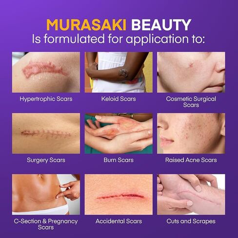 Silicone Scar Sheets for Surgical Scars: Silicone Gel Sheets for Keloids, Burns, Abrasion and C-Section - Safe for Adults and Children - Breathable, Skin-Friendly and Waterproof Silicone Tape 4PCS in Kuwait