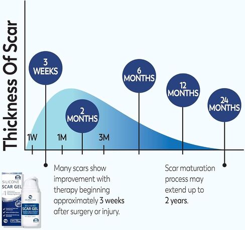 Silicone Scar Sheets for Surgical Scars: Silicone Gel Sheets for Keloids, Burns, Abrasion and C-Section - Safe for Adults and Children - Breathable, Skin-Friendly and Waterproof Silicone Tape 4PCS in Kuwait