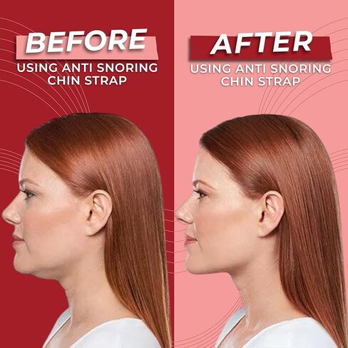 Premium Chin Strap for Sleeping, Breathable, Comfortable CPAP Chin Strap for snoring- Airflow jaw Strap for Men and Women, Adjustable Snore Stopper Chin Strap, Keep Mouth Closed While Sleeping in Saudi Arabia