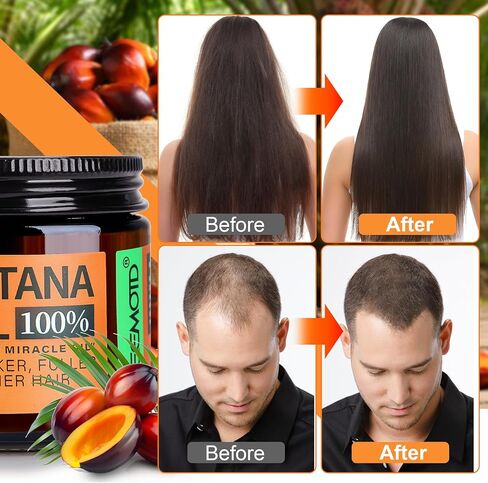 زيت باتانا غير مكرر لنمو الشعر ، د. in Kuwait