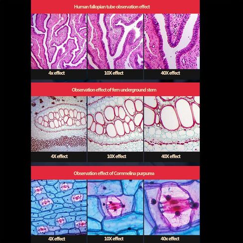 مجهر 40x-2500x عدسة موضوعية ميكروسكوب بيولوجي (10x/40x/100x) عدسة عينية (5x/10x/16x/25x) 2500 مرة + 5 مليون بكسل عدسة إلكترونية يمكن توصيلها بالهاتف المحمول 20x14x31 سم in Kuwait