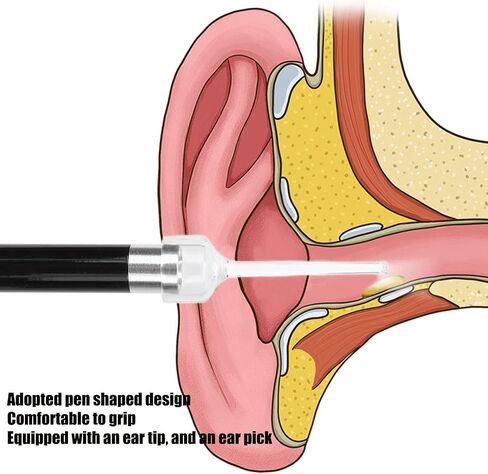 Ear Inspection Light,Ear Scope with Light, Ear Checking Penlight Ear Wax Removal Fitting Tool,Reusable LED Ear Penlight Nurse LED Pen Light with Pocket Clip for Torch Nursing in Saudi Arabia