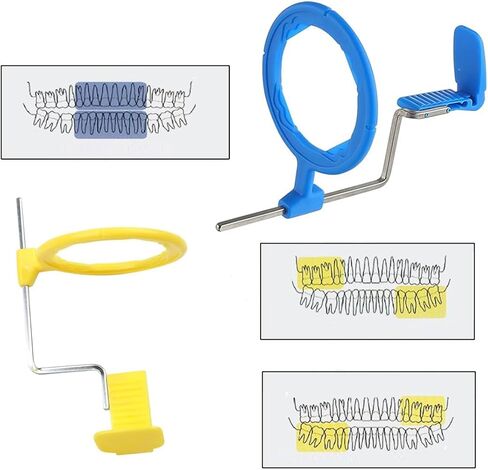 Dental X-Ray Film Positioning System Complete Kit - FPS 3000 Universal Intraoral Positioner Holders in Kuwait