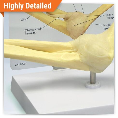 GPI Anatomicals - Foot and Ankle Model, Replica of Foot and Ankle with Plantar Fasciitis for Human Anatomy and Physiology Education, Anatomy Model for Doctor's Office, Medical Learning Resources in Kuwait