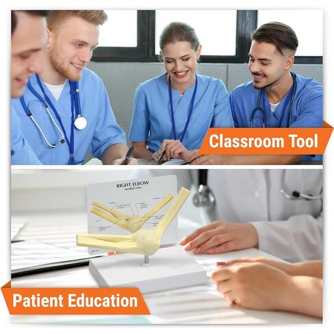 GPI Anatomicals - Foot and Ankle Model, Replica of Foot and Ankle with Plantar Fasciitis for Human Anatomy and Physiology Education, Anatomy Model for Doctor's Office, Medical Learning Resources in Kuwait