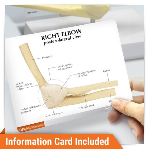 GPI Anatomicals - Foot and Ankle Model, Replica of Foot and Ankle with Plantar Fasciitis for Human Anatomy and Physiology Education, Anatomy Model for Doctor's Office, Medical Learning Resources in Kuwait