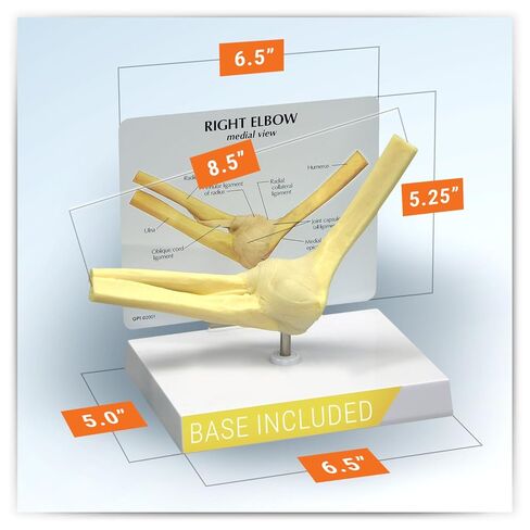 GPI Anatomicals - Foot and Ankle Model, Replica of Foot and Ankle with Plantar Fasciitis for Human Anatomy and Physiology Education, Anatomy Model for Doctor's Office, Medical Learning Resources in Kuwait