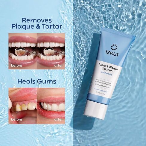 Plaque & Tartar Remover Toothpaste for Teeth: Removes Plaque & Reduces Tartar - Long-Lasting Fresh Breath, Gum-Friendly, SLS Free Dental Gel, Enamel Support Toothpaste for Adults & Kids, Wintergreen in Kuwait