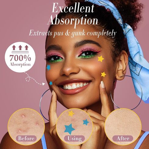Mandabloom Acne Patches Pimple Patches, Pink Heart & Star Shaped Acne Absorbing Cover Patch, Hydrocolloid Acne Patches For Face Zit Patch Acne Dots, Add Tea Tree Oil, 104 Patches, 14mm & 12mm in Saudi Arabia