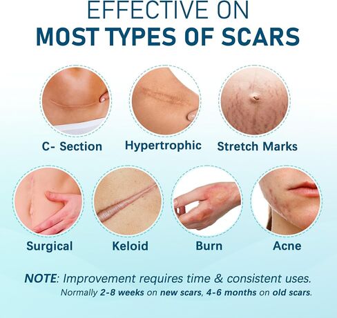 MEDLOT Silicone Scar Sheets, 10Pcs 4" x 7" Each, Medical Silicone Tape for Scar Treatment, Scar Patches for C-Section, Keloid Bump, Stretch Marks, Burn, Acne, Surgical Scar Removal in Saudi Arabia