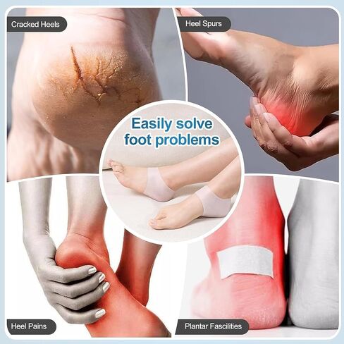 HEBEICRMY Silicone Heel Covers, Heel Cups, Plantar Fasciitis, Heel Pads, Cracked Heels & Achilles Tendinitis for Men and Women (1 Pair Blue and 1 Pair White) in Kuwait