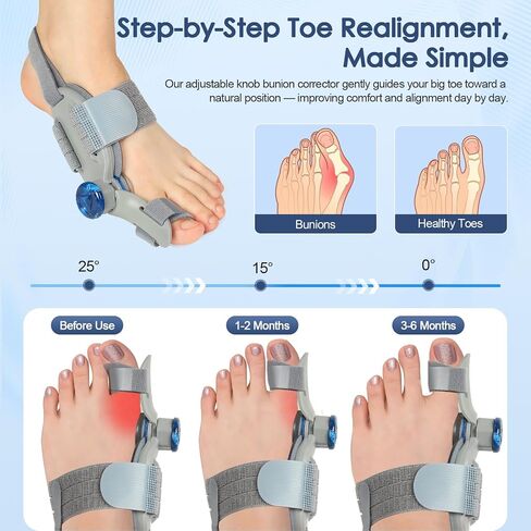 Bunion Corrector for Women Men Big Toe,Adjustable Knob Bunion Corrector for Bunion Relief,Bunion Fix with Bunion Silicone Pad,Suitable for Left and Right Feet(1PCS) in Saudi Arabia