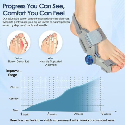 Bunion Corrector for Women Men Big Toe,Adjustable Knob Bunion Corrector for Bunion Relief,Bunion Fix with Bunion Silicone Pad,Suitable for Left and Right Feet(1PCS) in Saudi Arabia