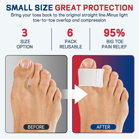 Big Toe Spacers,Hallux Valgus Corrector,Relieve Bunion Pain,Prevent Overlapping Toes, All-Day Comfort for Men & Women, Fits in Shoes. in Saudi Arabia