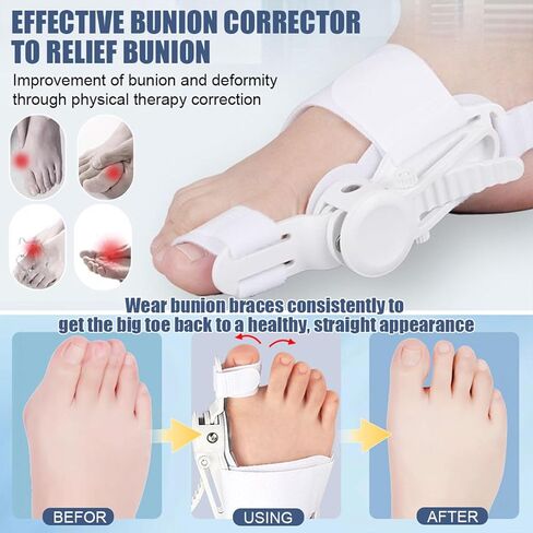 مصحح الورم للنساء والرجال من ريكوفيست - جبيرة أورام العظام لتقويم العظام لأصابع القدم الكبيرة للخياطين من أجل تخفيف آلام أروح المطرقة وأداة فرد أصابع القدم اليسرى/اليمين - قطعة واحدة باللون الأسود in Kuwait