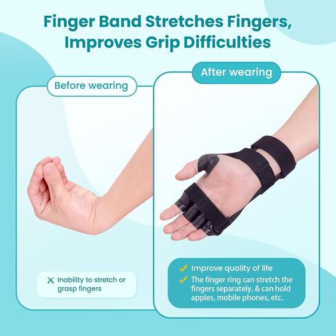 Radial Nerve Palsy Splint Brace for Wrist drop, 5 Fingers Extension, Stroke Patient Recovery, Finger Limp, Crutch Palsy, MCP Arthroplasty, for both Left and Right Hand - Black in Kuwait