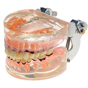 Doc.Royal Dental Study Transparent Adult Pathological Periodontal Disease Teeth Model 4017