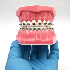 Fuioda Dental Orthodontic Typodont Model 1:1 Standard Size Teeth Model Typodont Demo for Patients Students