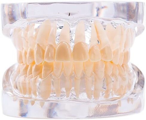 نموذج أسنان قياسي من SNAWOP نموذج أسنان كريستالي شفاف لتعليم وتعليم دراسة الأسنان عن طريق الفم in Kuwait