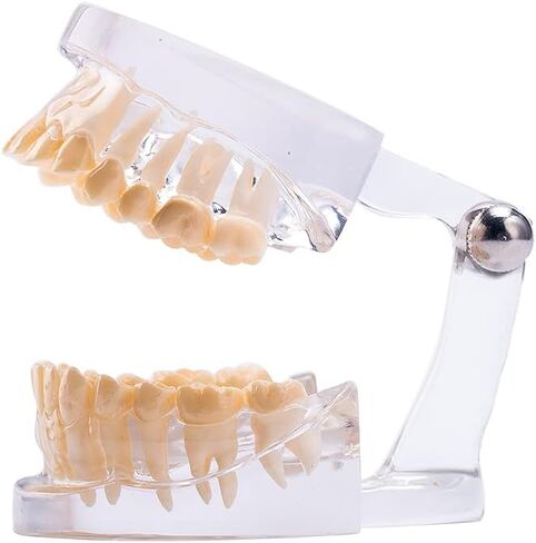 نموذج أسنان قياسي من SNAWOP نموذج أسنان كريستالي شفاف لتعليم وتعليم دراسة الأسنان عن طريق الفم in Kuwait