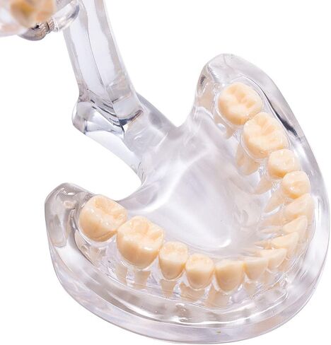 نموذج أسنان قياسي من SNAWOP نموذج أسنان كريستالي شفاف لتعليم وتعليم دراسة الأسنان عن طريق الفم in Kuwait