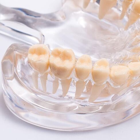نموذج أسنان قياسي من SNAWOP نموذج أسنان كريستالي شفاف لتعليم وتعليم دراسة الأسنان عن طريق الفم in Kuwait