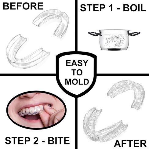 Small Mouth Guard for Kids – Custom Fit, Non-Bulky, Moldable – (4) Teeth Grinding Guards & Case – Comfortable Mouthguard for Children, Mouth Guards for Teeth Clenching, Clear in Saudi Arabia