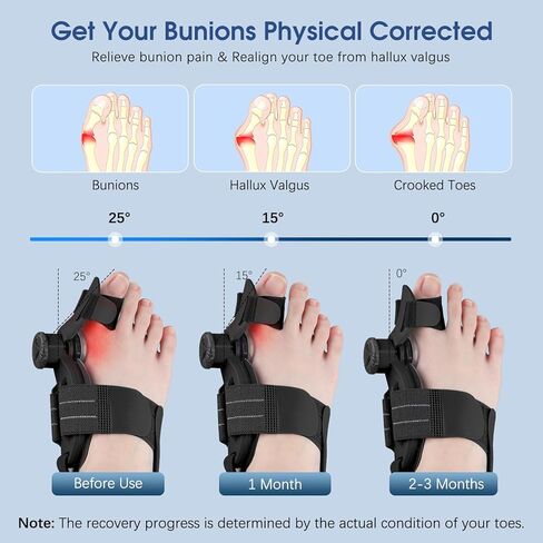 مصحح الورم للنساء والرجال إصبع القدم الكبير: إصلاح الورم قابل للتعديل لتخفيف آلام فصل إصبع القدم الكبير - جبيرة الورم العظمية مع مملس لمحاذاة أصابع القدم وتصحيح أروح القدم in Kuwait