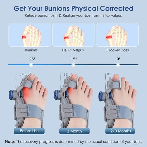 Bunion Corrector for Women & Men Big Toe: Adjustable Bunion Fix for Big Toe Separation Pain Relief - Orthopedic Bunion Splint with Straightener for Toes Alignment Hallux Valgus Correction in Kuwait