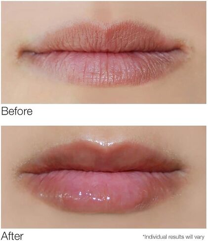 Dermelect Smooth Lip Volumizer for Lips - Anti Aging Plumper with Argan Oil, Shea Butter, Coconut Oil, Hyaluronic Acid Vitamin C Silkflo Hydrating Conditioning Lip Primer for Dryness Thin Lips .24 oz in Saudi Arabia