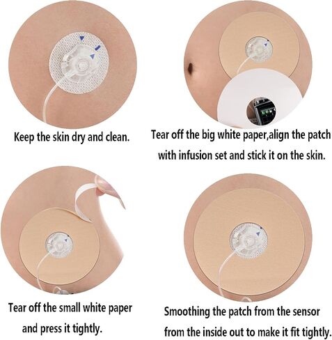 30 Pcs Waterproof Infusion Site CGM Adhesive Patches for Medtronic 780G/770G, Tandem t:Slim X2/ Mobi - Hypoallergenic Sensor Adhesive Tape with 0.8" Hole, 14-Day Wear, Pre-Cut Breathable Clear Patch in Saudi Arabia